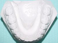 active_retainer5