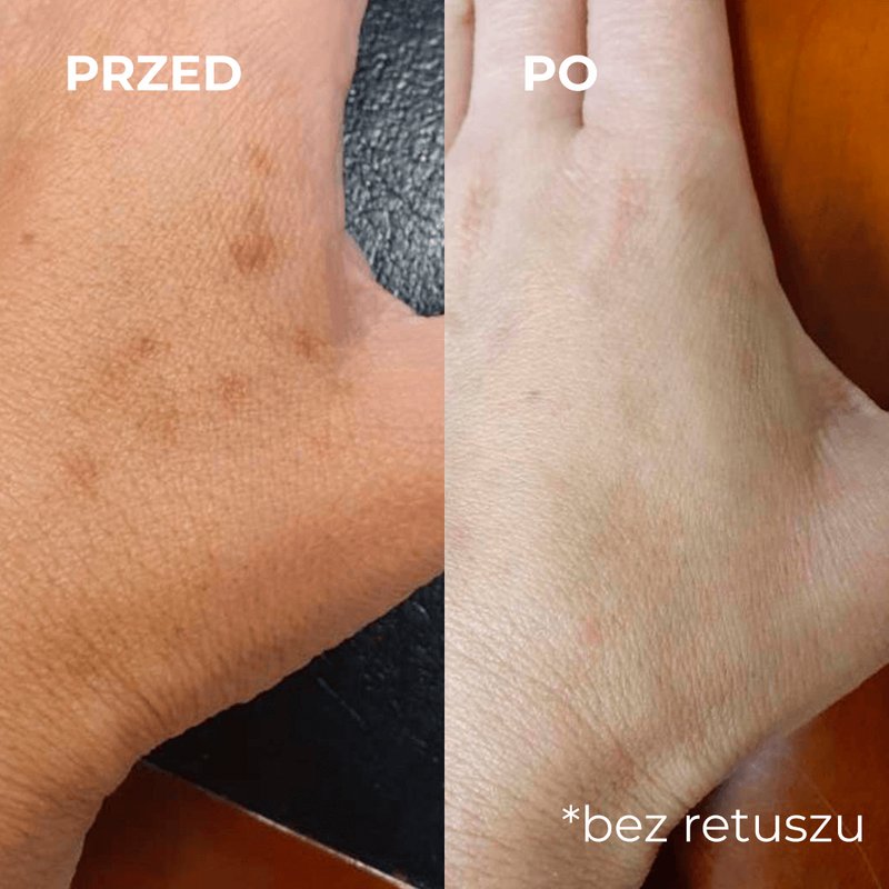 Premium Vision - Lek, Masc i Maść - Jak Skutecznie Leczyć Stawy w Polsce?